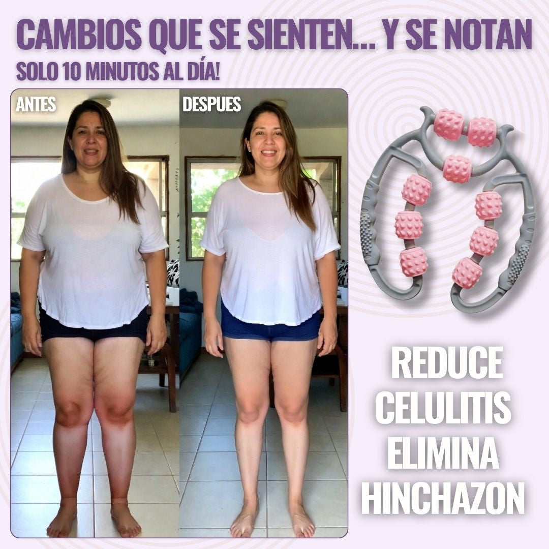 SlimLeggys™- Reduce las Celulitis con solo 10 minutos al día!