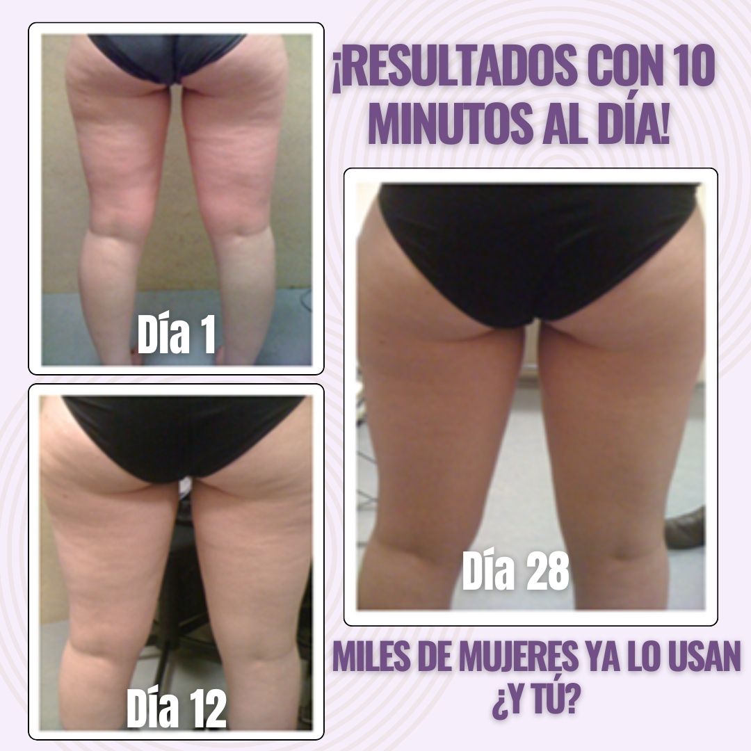 SlimLeggys™- Reduce las Celulitis con solo 10 minutos al día!