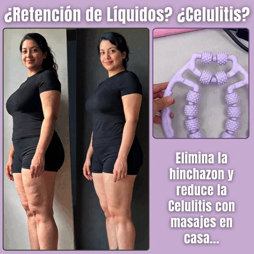 SlimLeggys™- Reduce las Celulitis con solo 10 minutos al día!