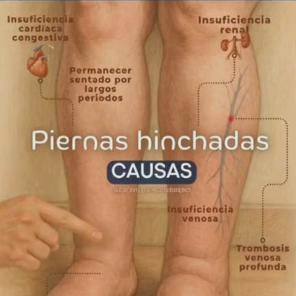 SlimLeggys™- Alivio Real para Piernas Hinchadas con solo 10 minutos al día!